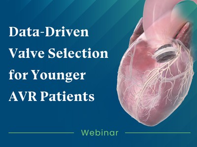 How Contemporary Data is Shifting the AVR Paradigm