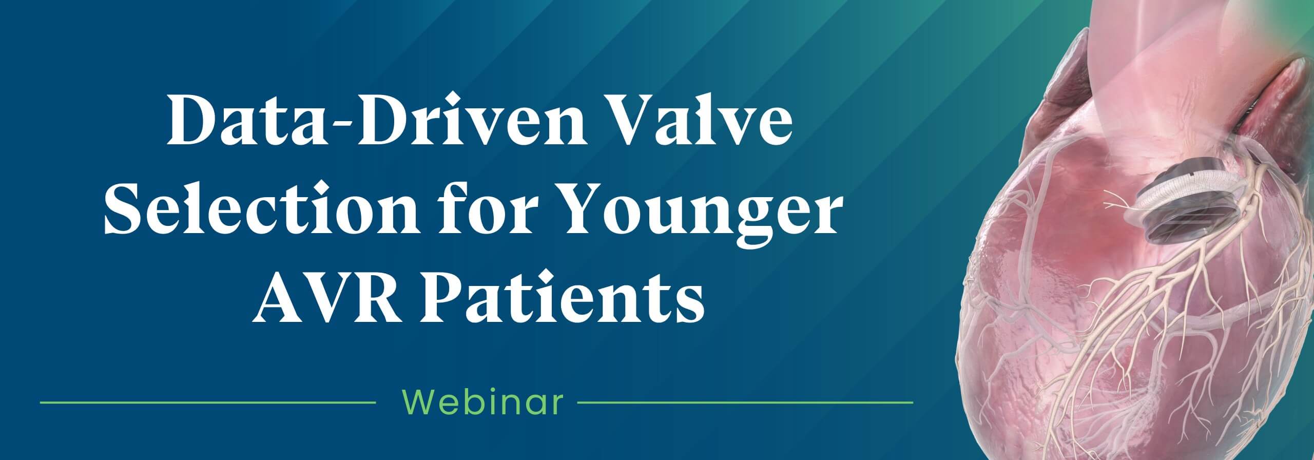 How Contemporary Data is Shifting the AVR Paradigm