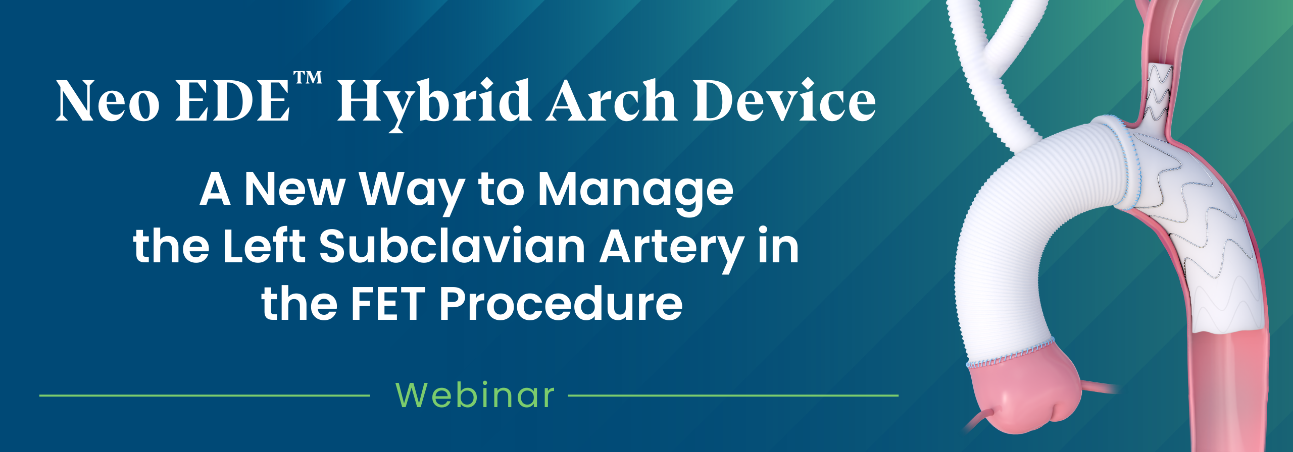 Stenting the Left Subclavian Branch: First-in-Man Frozen Elephant Trunk with a New Custom-Made Hybrid Stent Graft System