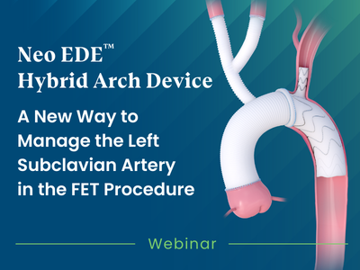 Stenting the Left Subclavian Branch: First-in-Man Frozen Elephant Trunk with a New Custom-Made Hybrid Stent Graft System